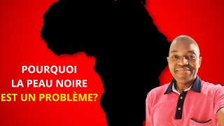 Libre AntennePourquoi la peau noire estelle encore un problème actuel La faute aux africains [upl. by Idhem]