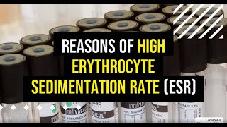 High Erythrocyte Sedimentation Rate ESR Blood Test [upl. by Lotsyrk219]