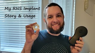 My RNS Implant Story amp Usage [upl. by Hanas]