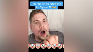 Orthodontist Reacts Man Leaves Retainer In For 5 Years 🤢 [upl. by Rozina]