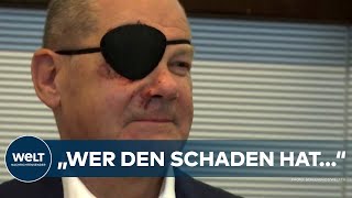 PIRATENKANZLER Olaf Scholz kommt mit Augenklappe zur Arbeit – Mit diesen Memes reagiert das Netz [upl. by Vlada]