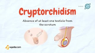 Cryptorchidism  Undescending Testicles  Causes Pathology  Pediatrics Video Lecture [upl. by Aneev]