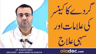 Kidney Cancer In Urdu  Gurde Ka Cancer Ki Alamat Aur Ilaj  Kidney Cancer Symptoms amp Treatment [upl. by Hobart573]