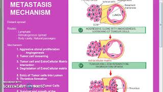 Pathology 193 c Metastasis Mechanism 1 [upl. by Ayifa]