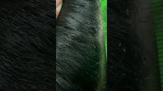 Dandruff Scratching video already up [upl. by Zannini]