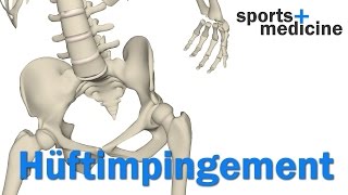 Hüftimpingement  Was ist das femoroacetabuläres Impingement FAI [upl. by Colby]