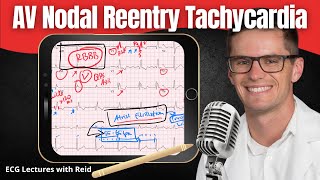 AV Nodal Reentry Tachycardia AVNRT EKG  ECG Lecture [upl. by Erl]