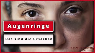 Was sind die URSACHEN für Augenringe und dunkle Augenschatten Plastische Chirurgie  Dr Alawi [upl. by Safier]