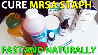 Cure MRSA Staph Infection Fast Natural Treatment [upl. by Okier]