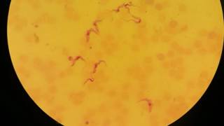 Trypanosoma gambiense trypomastigote [upl. by Wayland]