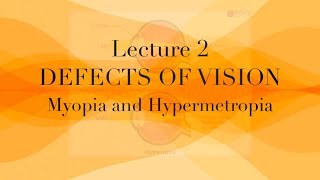 Defect of vision Class 10th  myopia  hypermetropia  presbyopia  Ncert [upl. by Annaya]