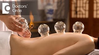 Is Cupping Therapy or Al Hijama painful  Dr Shagufta Siraj [upl. by O'Carroll]