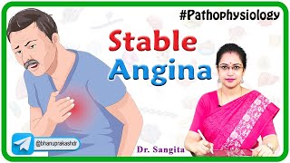 Stable Angina Causes Pathophysiology Symptoms Diagnosis and Treatment  Internal medicine [upl. by Haimehen]