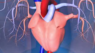 Implantable CardioverterDefibrillator ICD [upl. by Neeleuqcaj]