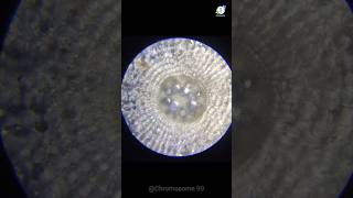 Monocot root in Microscope view microscope tranding viralshorts shorts short [upl. by Aiciled661]