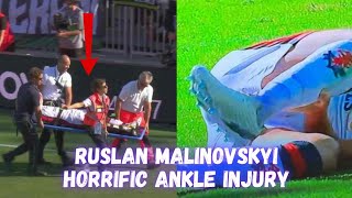 Ruslan Malinovskyi Horrific Injury vs Genoa  Genoa Vs Venezia  20  Malinovskyi Ankle Injury [upl. by Gavin]