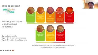 Lecture Eyes on the Future Diabetic Retinopathy Screening through Innovative Technologies [upl. by Anthia]