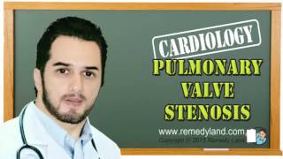 Pulmonary valve stenosis  clinical picture symptoms and signs ECG treatment Prognosis [upl. by Ardnaik194]