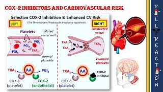 Celecoxib and its side effects  MOA  Stroke  MI [upl. by Thebault]