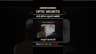 Optic Neuritis neurologist [upl. by Mcquade441]