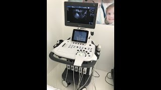 sonoscape S40 abdominal doppler ultrasound baby scan [upl. by Crabb]