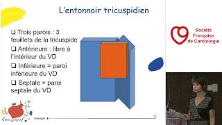 La valve tricuspide congénitale  Ebstein dysplasie  Anatomie [upl. by Jillane]