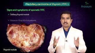 Thyroid neoplasms part 3  Medullary carcinoma of thyroid   Endocrine pathology [upl. by Yentroc]