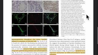 Does a thyroid storm go undiagnosed 85 year old man who died of COVID19 [upl. by Kostman]