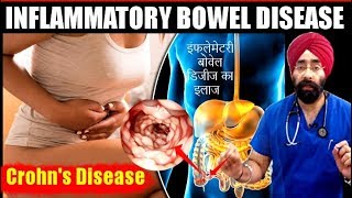 DIET for IBD  Crohns Disease का मेडिकल कारन और इलाज  Explained in HIndi by DrEducation [upl. by Newfeld]