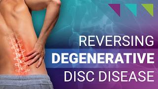 Reversing Degenerative Disc Disease [upl. by Eremehc323]