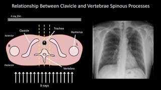 How to Interpret a Chest XRay Lesson 3  Assessing Technical Quality [upl. by Adnamor]