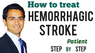 Hemorrhagic Stroke Intracerebral Hemorrhage Emergency Treatment Management Medicine Lecture USMLE [upl. by Nilra606]