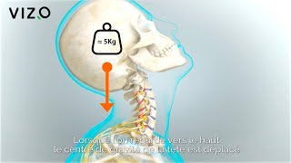 Extension cervicale Douleur au cou arthrose cervicale fourmillement dans les bras [upl. by Boyt]