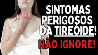 OS 4 SINTOMAS MAIS PERIGOSOS DA TIRÓIDEO  Dr Dayan Siebra [upl. by Laryssa]