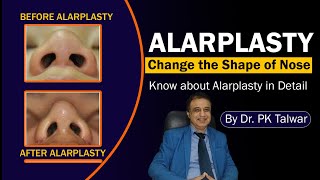 Alarplasty Surgery Alarplasty in Delhi India Nose Surgery Alarplaty Surgery Cost Dr PK Talwar [upl. by Eadrahs]