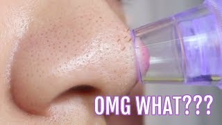 I didnt expect that NEW Pore  Blackhead SUCKING Vacuum [upl. by Htebilil]