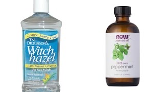 Starter Locs  How to Clean Your Scalp with Witch Hazel [upl. by Kevan814]