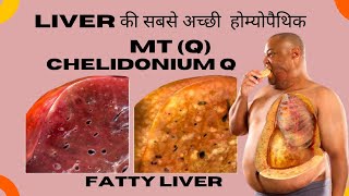 LIVER की सबसे अच्छी होम्योपैथिक MT Q ll CHELIDONIUM Q ll FATTY LIVER HEPATOMEGALY  ACIDITY ll [upl. by Fiorenza246]