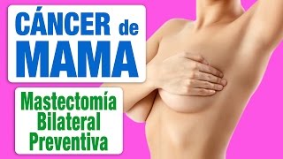 Cáncer de Mama y Mastectomía Bilateral Profiláctica [upl. by Arabella776]