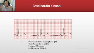 Taquiarritmias e Bradiarritmias [upl. by Rellia431]