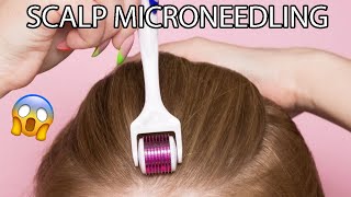 SCALP MICRONEEDLING AT HOME  HAIR LOSS TREATMENT AD [upl. by Latsirhc]