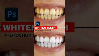 Whiten Teeth Tutorial photoshop shorts photoshoptutorial [upl. by Ahcsas891]