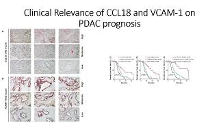 Clinical Relevance of VCAM1 and CCL18 on Pancreatic Cancer PDAC prognosis Code 671 [upl. by Atinwahs966]