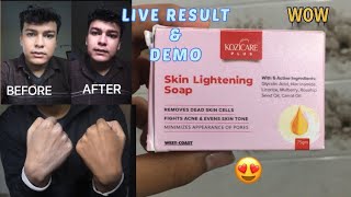 Kozicare Skin Lightening Soap Review  Kozicare Skin Whitening Soap Review in Hindi [upl. by Idnyl]