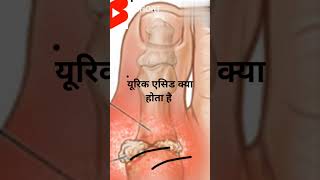 यूरिक एसिड क्या है what is uric acidmy short video viral [upl. by Dnalerb]