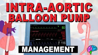 Management of the IntraAortic Balloon Pump IABP [upl. by Atiuqihc]