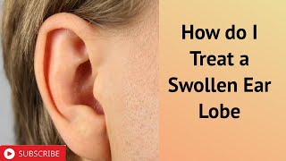 How do I Treat a Swollen Ear Lobe [upl. by Reham728]