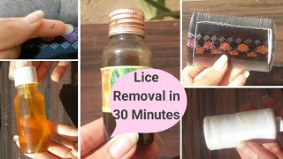 Lice Removal Treatment At home  Lice eggs Nits lice remedy Remove lice from head  Glow Yourself [upl. by Littlejohn]