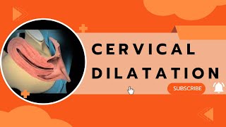 Cervical Dilatation [upl. by Bo246]