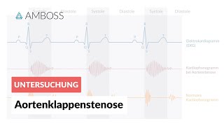 Aortenklappenstenose  Herzgeräusch  AMBOSS Video [upl. by Audrye]